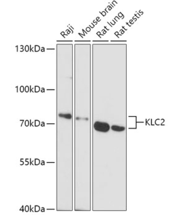KLC2 Rabbit Polyclonal Antibody
