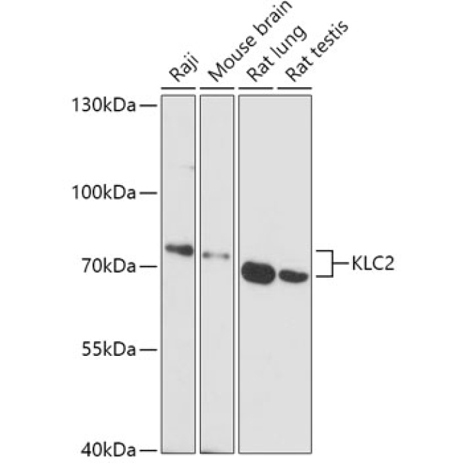 KLC2 Rabbit Polyclonal Antibody