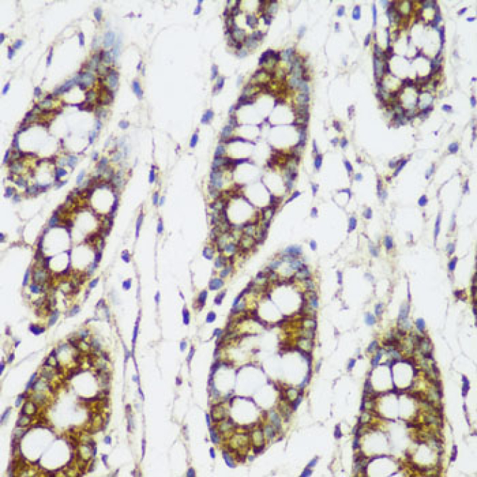 FNDC4 Rabbit Polyclonal Antibody