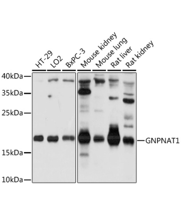 GNPNAT1 Rabbit Polyclonal Antibody