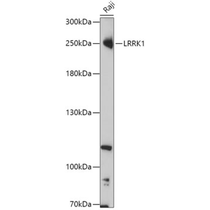 LRRK1 Rabbit Polyclonal Antibody