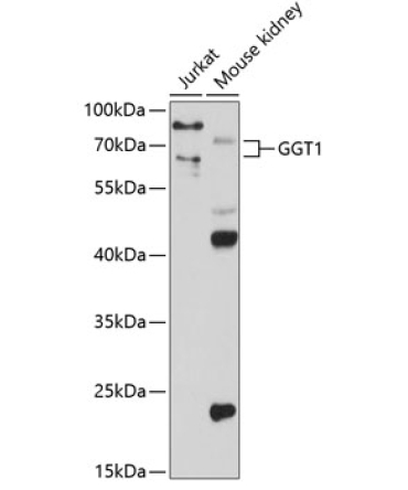 GGT1 Rabbit Polyclonal Antibody