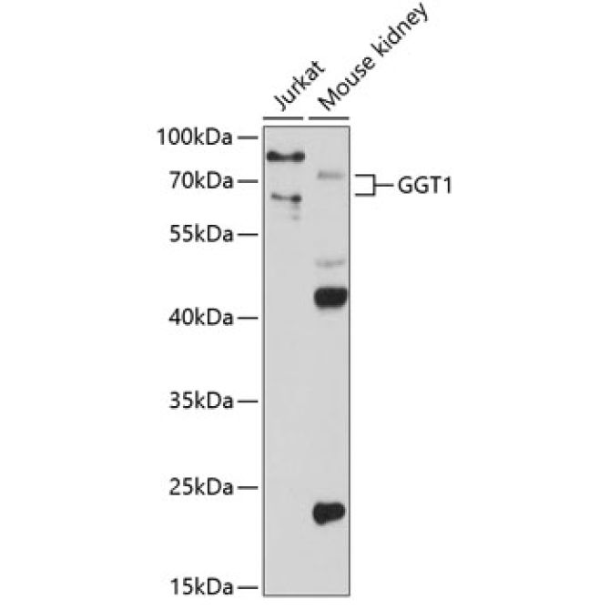 GGT1 Rabbit Polyclonal Antibody