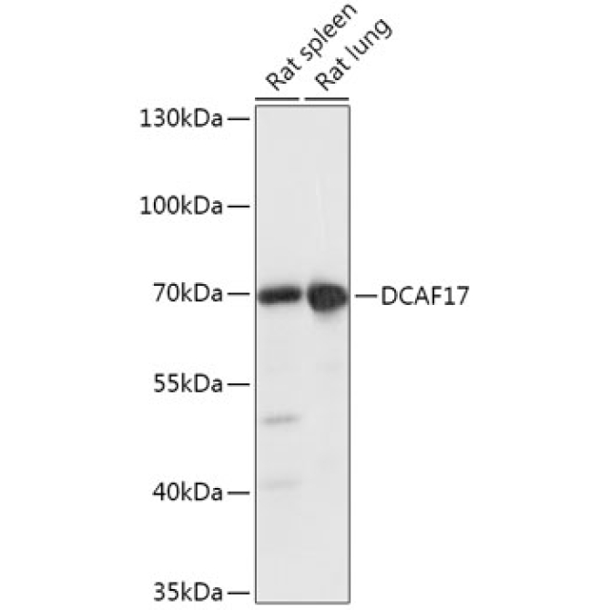 DCAF17 Rabbit Polyclonal Antibody