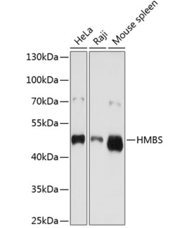 HMBS Rabbit Polyclonal Antibody
