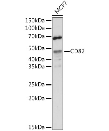 CD82 Rabbit Polyclonal Antibody
