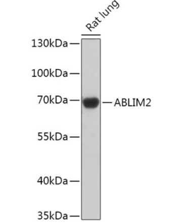 ABLIM2 Rabbit Polyclonal Antibody
