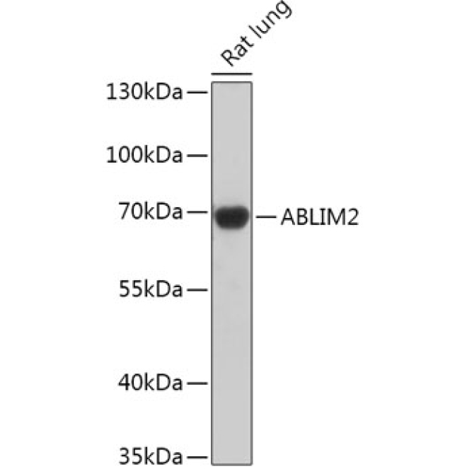 ABLIM2 Rabbit Polyclonal Antibody