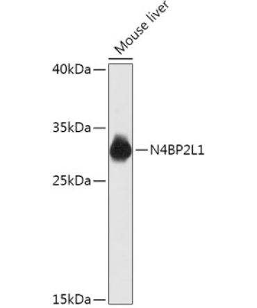 N4BP2L1 Rabbit Polyclonal Antibody