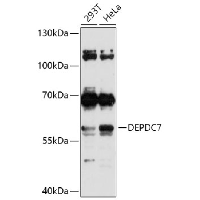 DEPDC7 Rabbit Polyclonal Antibody