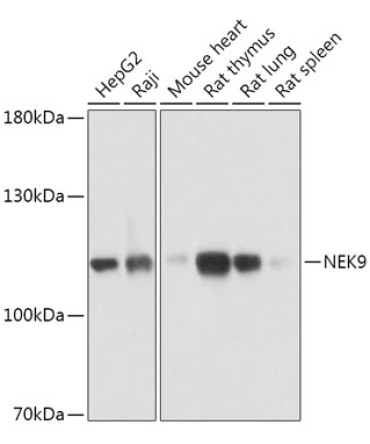 NEK9 Rabbit Polyclonal Antibody