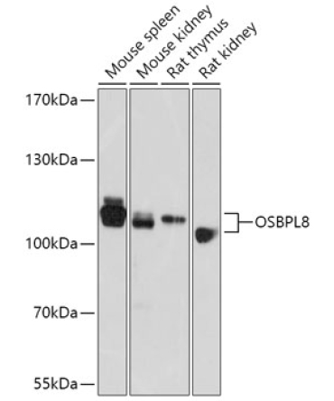 OSBPL8 Rabbit Polyclonal Antibody