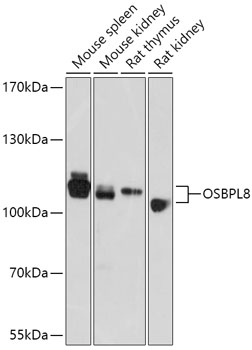 OSBPL8 Rabbit Polyclonal Antibody