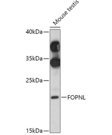FOPNL Rabbit Polyclonal Antibody