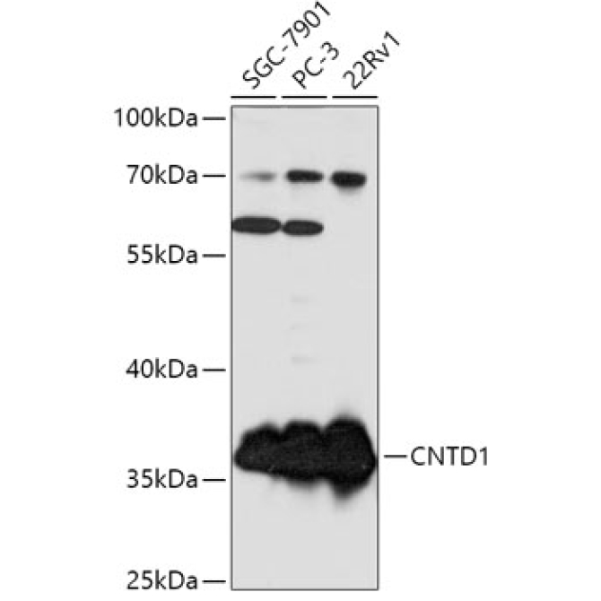 CNTD1 Rabbit Polyclonal Antibody