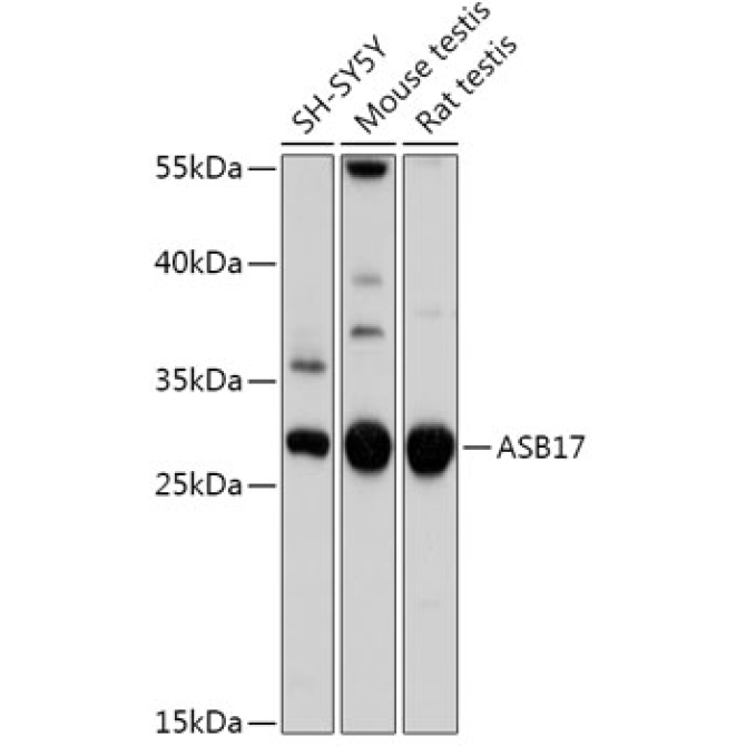 ASB17 Rabbit Polyclonal Antibody