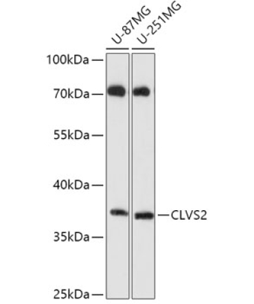 CLVS2 Rabbit Polyclonal Antibody