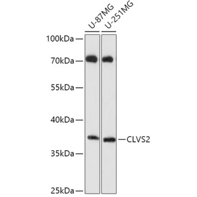 CLVS2 Rabbit Polyclonal Antibody