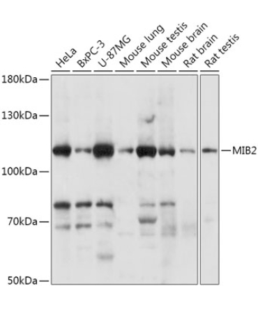 MIB2 Rabbit Polyclonal Antibody