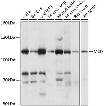 MIB2 Rabbit Polyclonal Antibody