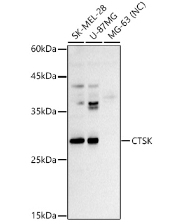 CTSK Rabbit Polyclonal Antibody