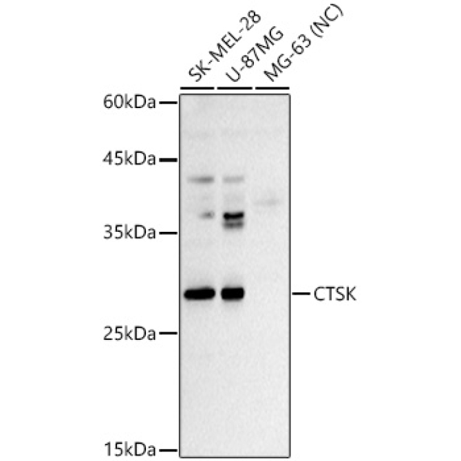 CTSK Rabbit Polyclonal Antibody