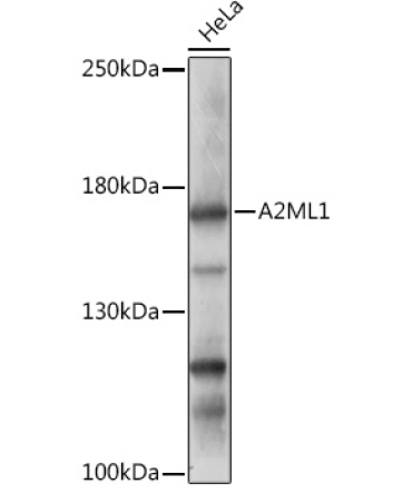 A2ML1 Rabbit Polyclonal Antibody
