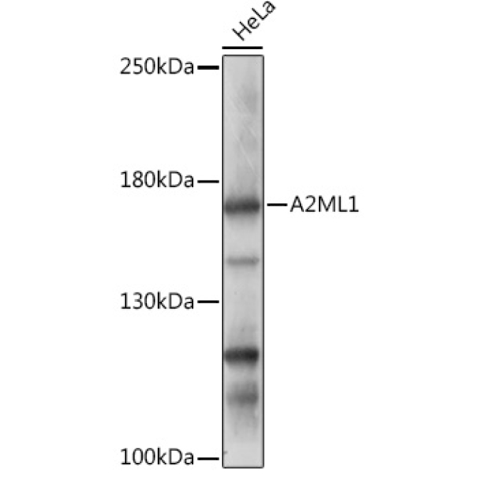 A2ML1 Rabbit Polyclonal Antibody