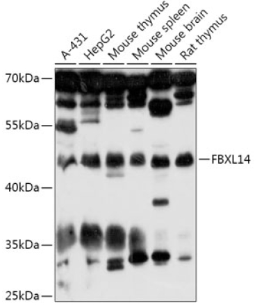 FBXL14 Rabbit Polyclonal Antibody