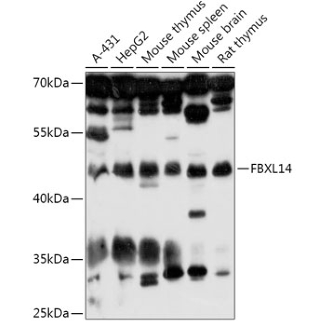 FBXL14 Rabbit Polyclonal Antibody