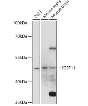 IGSF11 Rabbit Polyclonal Antibody