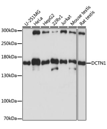 DCTN1 Rabbit Polyclonal Antibody