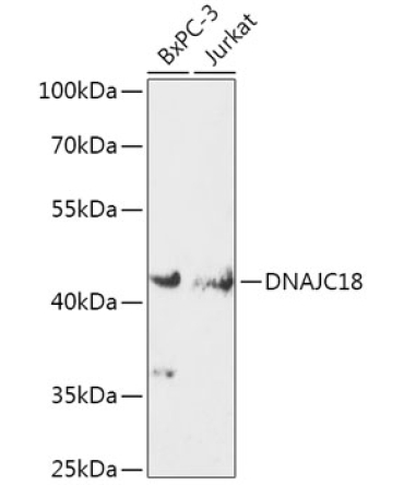 DNAJC18 Rabbit Polyclonal Antibody
