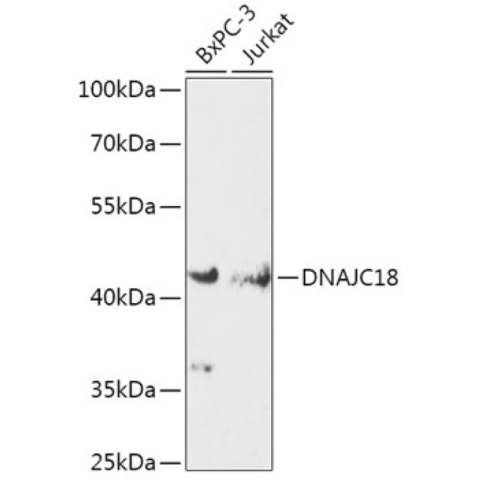 DNAJC18 Rabbit Polyclonal Antibody