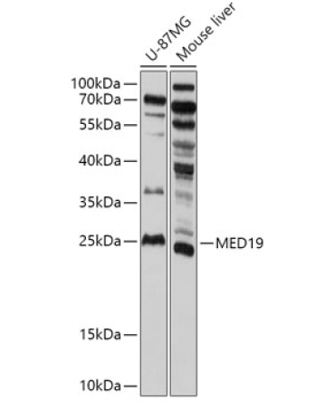 MED19 Rabbit Polyclonal Antibody
