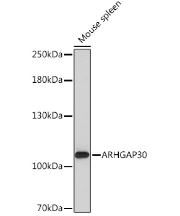 ARHGAP30 Rabbit Polyclonal Antibody