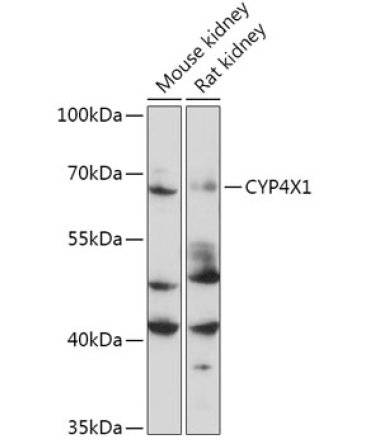 CYP4X1 Rabbit Polyclonal Antibody