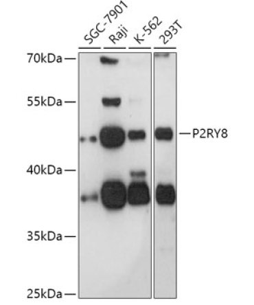 P2RY8 Rabbit Polyclonal Antibody