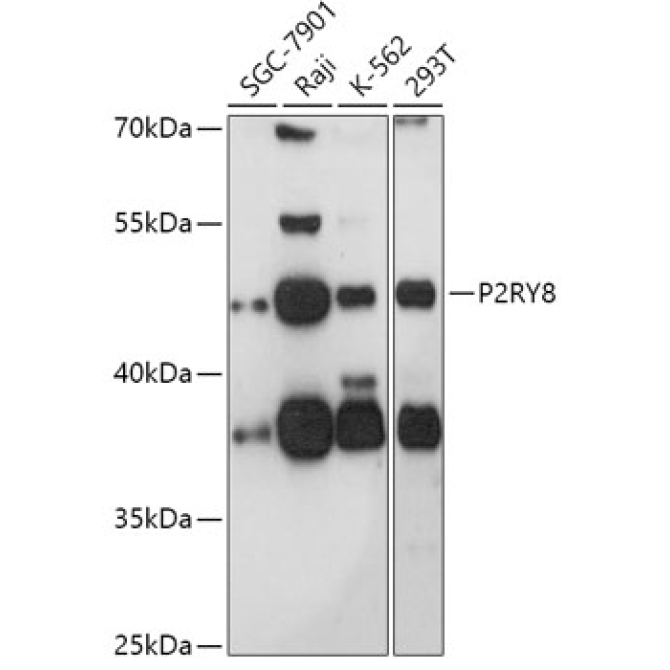P2RY8 Rabbit Polyclonal Antibody