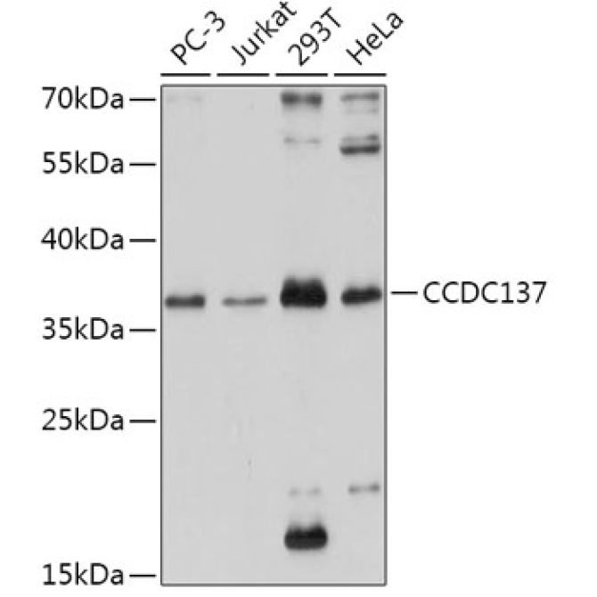 CCDC137 Rabbit Polyclonal Antibody