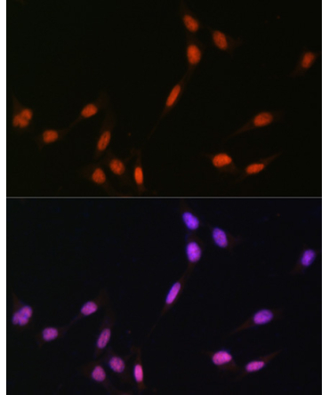 MonoMethyl-Histone H4-K5 Rabbit Polyclonal Antibody