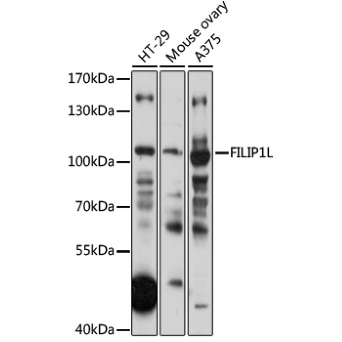 FILIP1L Rabbit Polyclonal Antibody