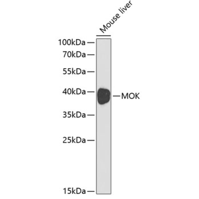MOK Rabbit Polyclonal Antibody