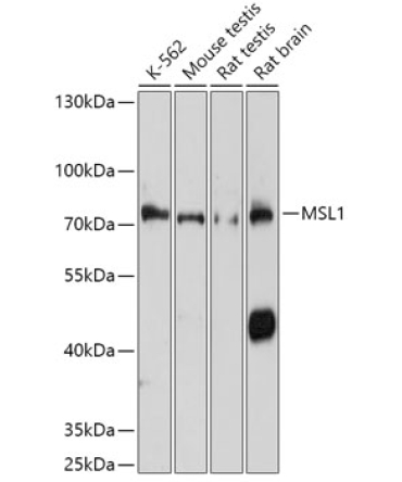 MSL1 Rabbit Polyclonal Antibody