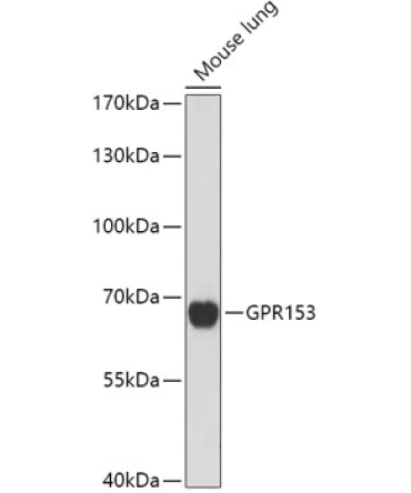GPR153 Rabbit Polyclonal Antibody