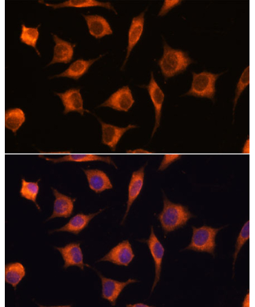 GBAS Rabbit Polyclonal Antibody