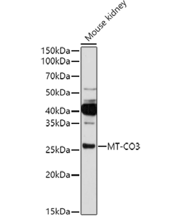 MT-CO3 Rabbit Polyclonal Antibody
