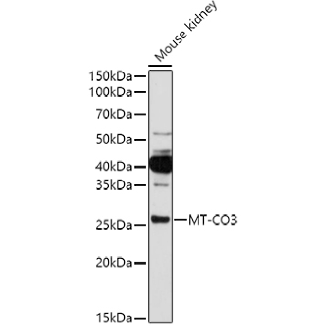 MT-CO3 Rabbit Polyclonal Antibody