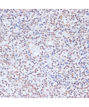 Acetyl-Histone H1.4-K26 Rabbit Polyclonal Antibody