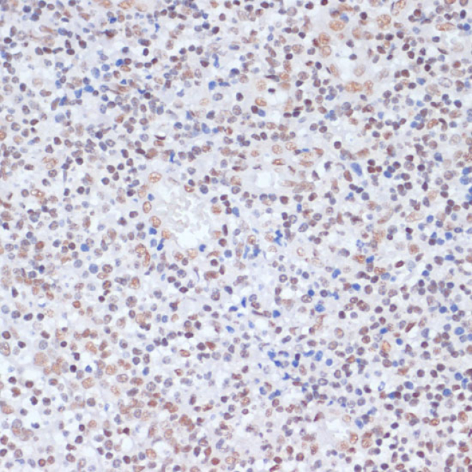 Acetyl-Histone H1.4-K26 Rabbit Polyclonal Antibody